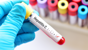 Hepatitidu C už lékaři umějí snadno vyléčit. Jen se na ni musí přijít  